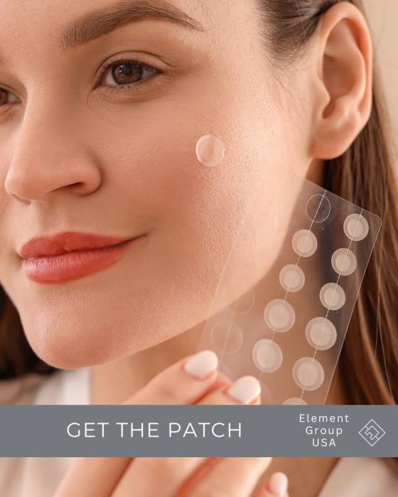 Get The Patch!